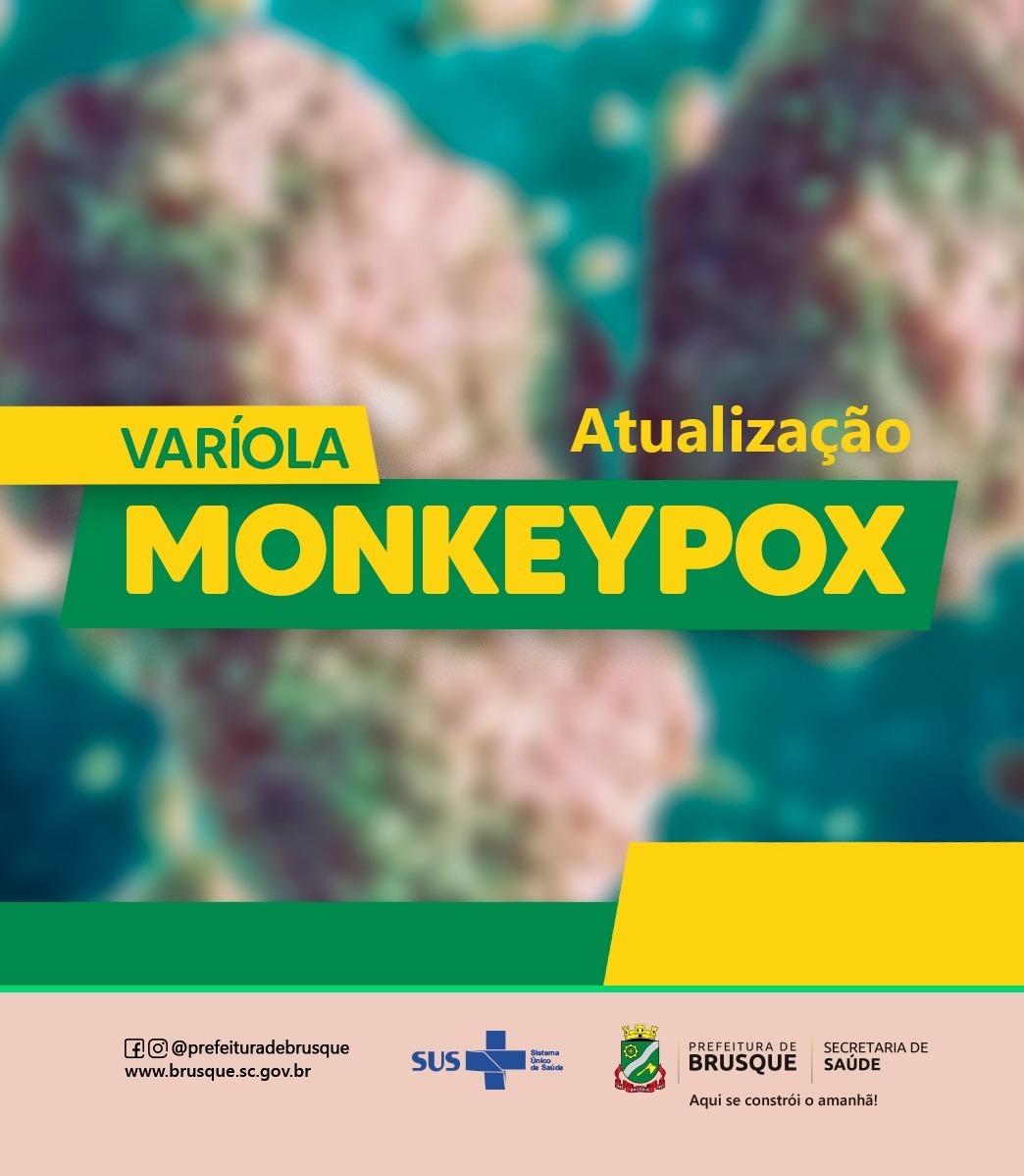 Secretaria de Saúde de Brusque atualiza os números da varíola monkeypox